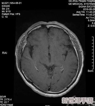 9分42秒头撞玻璃会怎样？这种意外事故可能导致严重的脑部损伤和其他身体伤害，值得引起重视