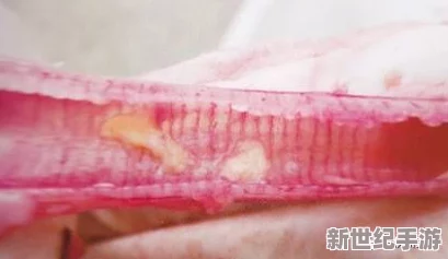 八重神子流出白色脓状物，医生表示需进一步检查以确定病因和治疗方案