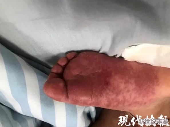 尿道口两边的肉肿了的原因及其可能引发的健康问题与治疗建议分析